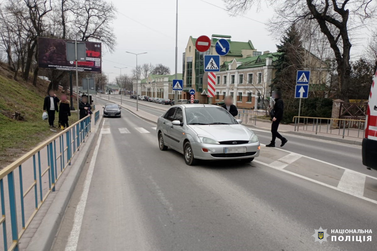 На Вінниччині автомобіль збив дівчинку на «зебрі»