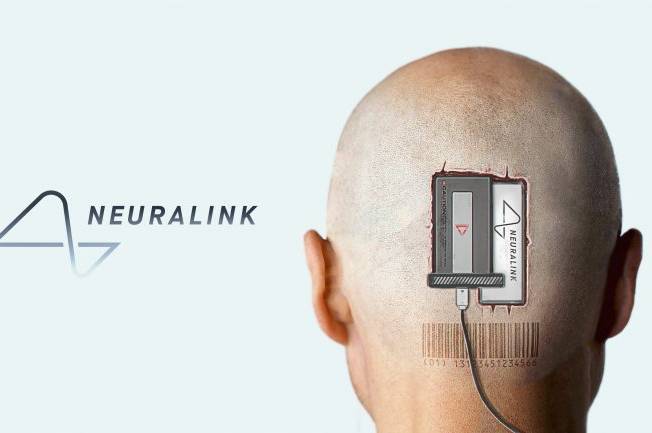 Компанія Neuralink Ілона Маска вживила перший імплант у мозок людини