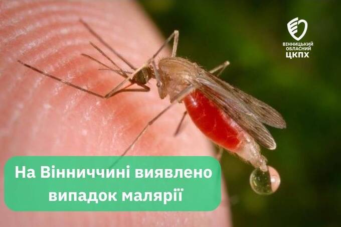 Жінка з Вінницького району захворіла на малярію: що відомо