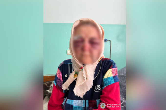 Побив пенсіонерку та забрав усі гроші: на Вінниччині чоловік напав на літню жінку