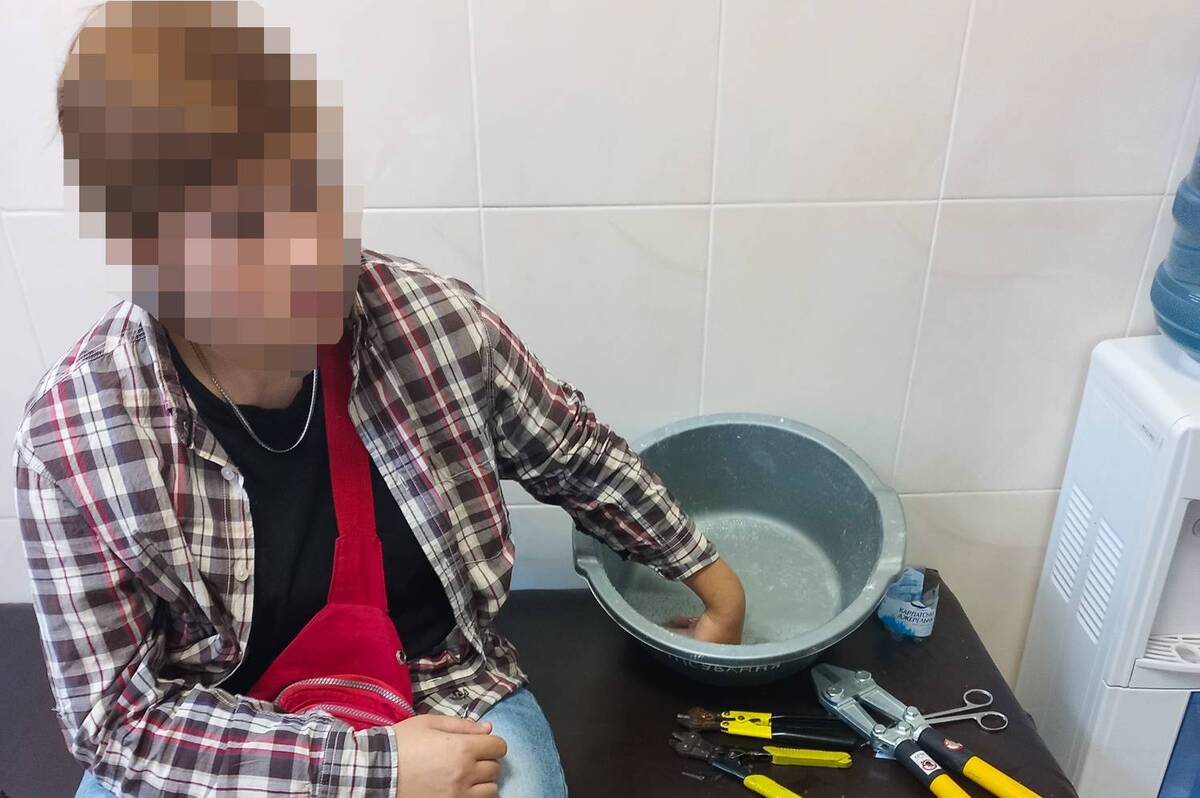 У Вінниці рятувальники у лікарні знімали каблучку з пальця 17-річної дівчини