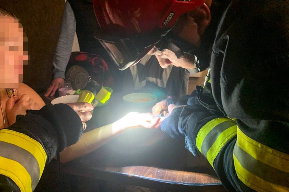 Рятувальникам довелося різати обручку, щоб врятувати палець вінничанки