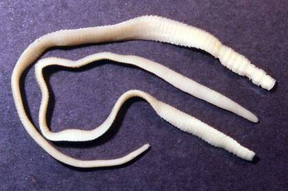 У Вінниці у однорічної дитини виявили карликового ціп’яка: що потрібно знати про гіменолепідоз