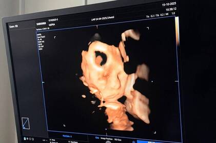 Медицина майбутнього у Вінниці: перший в Україні ультразвук нового покоління