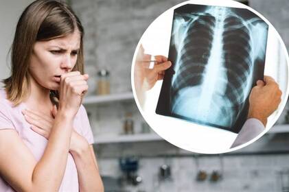 У Вінницькій області зростає кількість випадків туберкульозу: статистика за 2025 рік