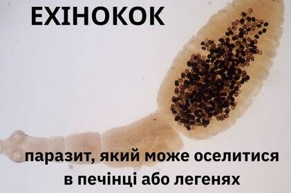 Паразит, який роками «мовчить»: що потрібно знати про ехінококоз