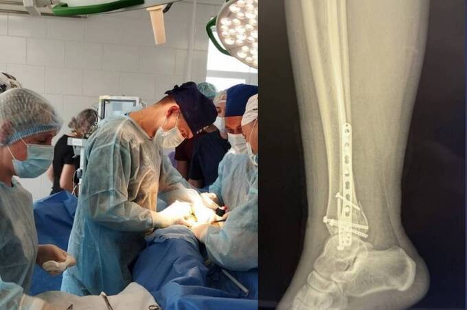 Вінницькі хірурги врятували ногу підлітка, який серйозно травмувався на самокаті