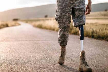 У Вінниці ветерани з ампутаціями можуть отримати відшкодування за оздоровлення: як отримати виплату