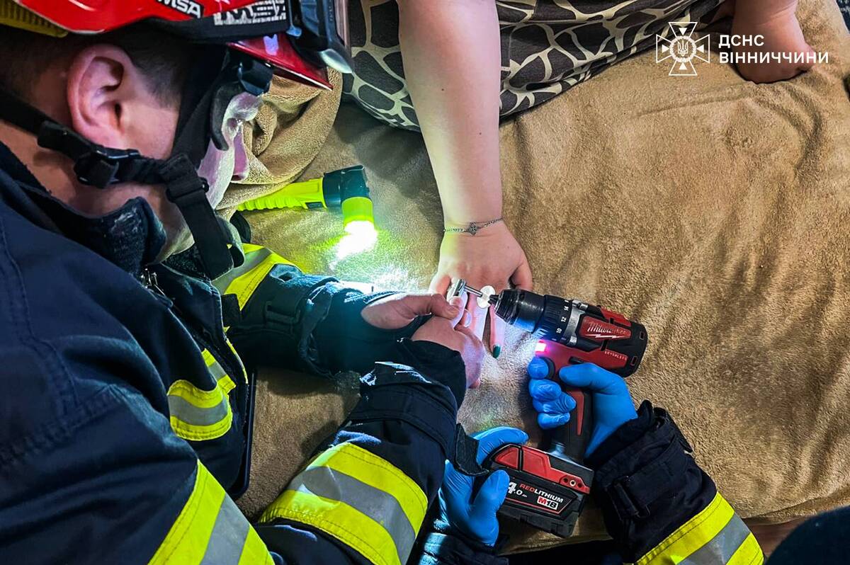 Вінницькі рятувальники допомогли вінничанці зняти обручку з набряклого пальця