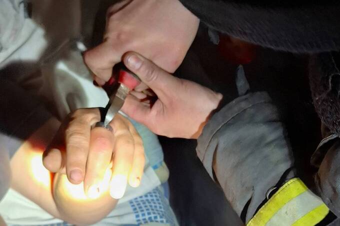 На Вінниччині рятувальники звільнили жінку з «металевої пастки»