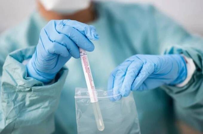 На Вінниччині зафіксували перший випадок субваріанту COVID-19 «Цикада»